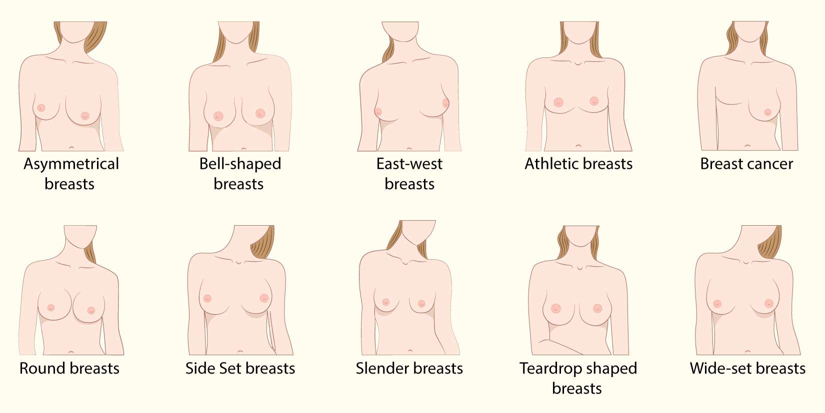 Different Types of Breast Shapes