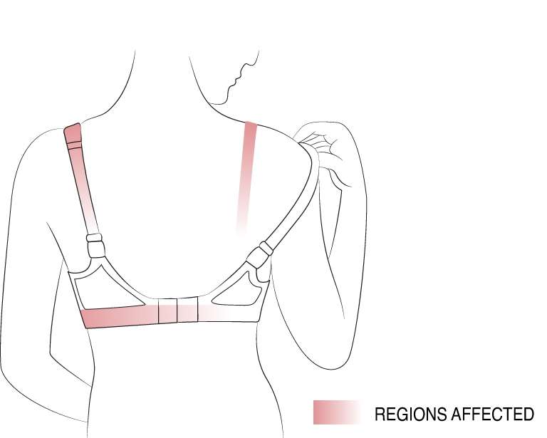 Check for Bra Chafing