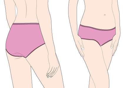 Avoid Wearing a Tight Underwear