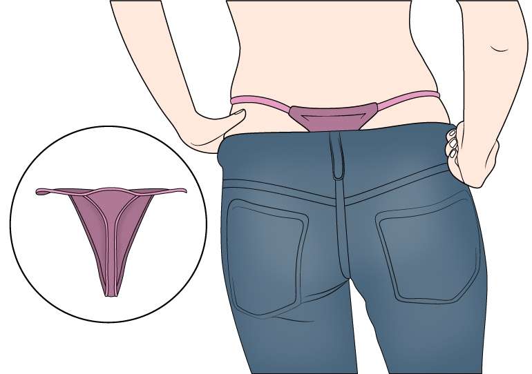Thongs Are Not for Everyday