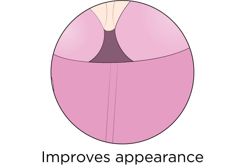 Improves Appearance