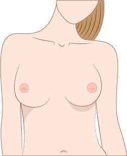Side Set Breasts