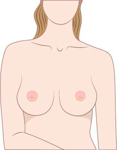 Teardrop shaped Breasts
